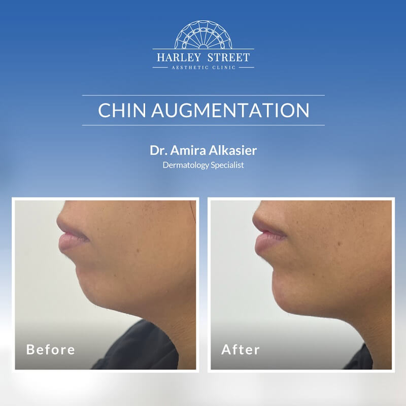 Dr. Amira Chin Augmentation Abu Dhabi